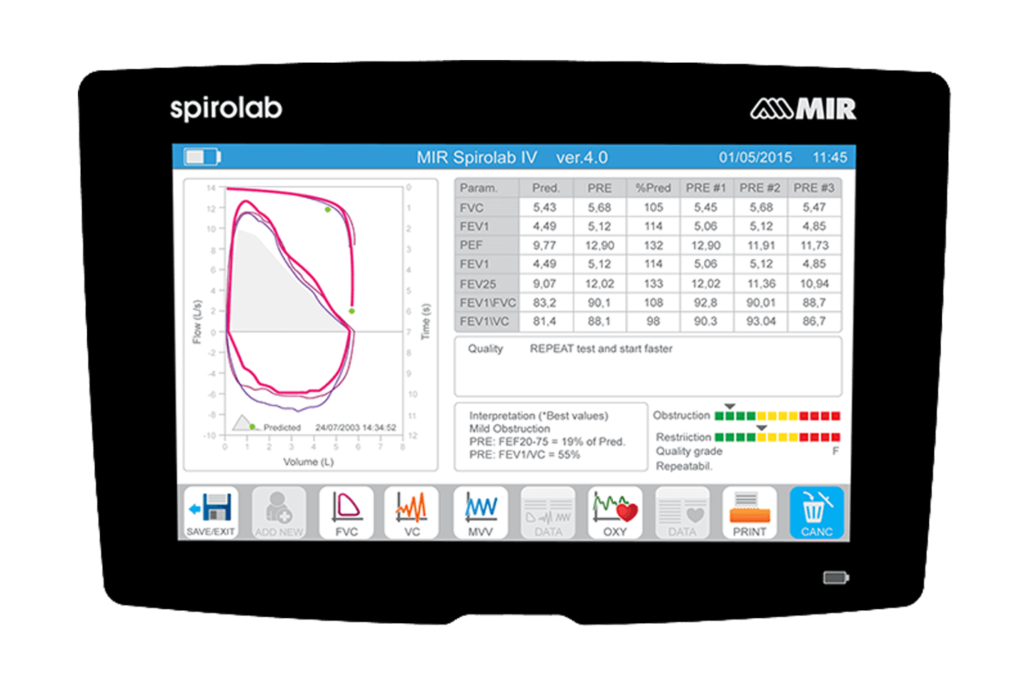 06_Spirolab_Top_View_Spirometry_Results.png